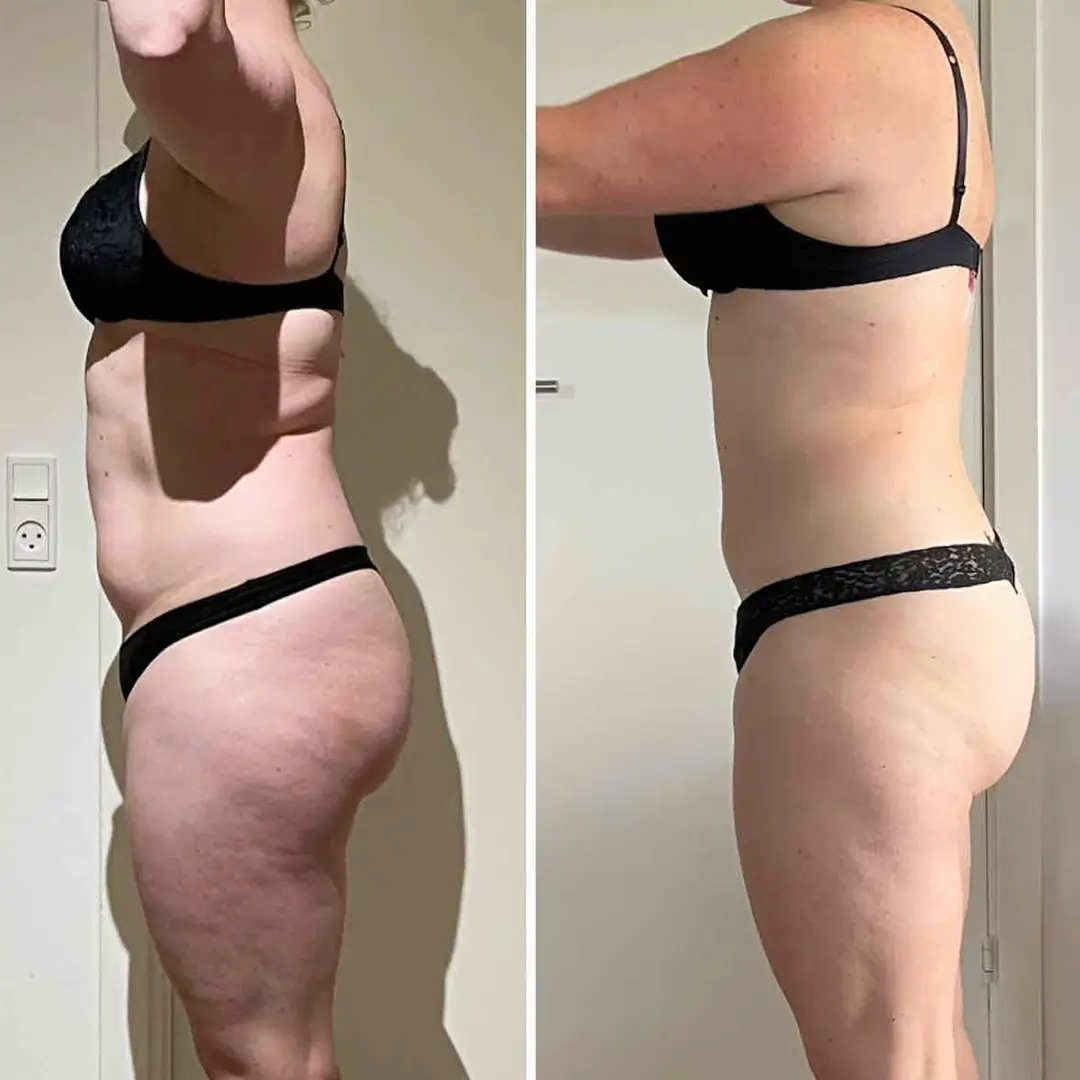 Woman side torso before and after online coaching